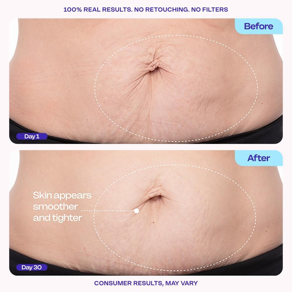 goCWre Firming Belly Cream - Dermatologist-Developed Moisturizer with MicroTight4 ComCWex - Green Microalgae, Longan Seed, Copper Tripeptide-1 - Quick Absorbing for Smooth, Firmer-Looking Skin