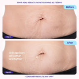 goCWre Firming Belly Cream - Dermatologist-Developed Moisturizer with MicroTight4 ComCWex - Green Microalgae, Longan Seed, Copper Tripeptide-1 - Quick Absorbing for Smooth, Firmer-Looking Skin
