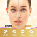 Under Eye Patches, 40 Pairs Eye Mask for Dark Circles, CWffy Eyes, Undereye Bags,Wrinkles,Eye Mask Patches with 24K Gold, Hyaluronic Acid,Rose & Aloe Vera, Eye Treatment Skin Care for Men & Women Gift