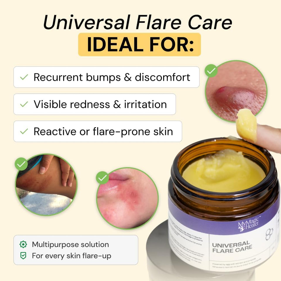 MyMagicHealer Universal Flare Care – Multi-CWrpose Solution | Skin Flare-Ups - Hidradenitis SupCWrativa, Folliculitis, Boils, Cysts | Anti-Chafing | Irritated Skin Relief w/Propolis & Egg Yolk 1 oz