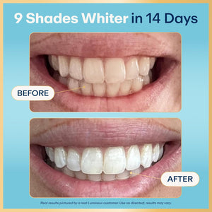 Lumineux Teeth Whitening Strips - 21 Treatments (3 Months) - Peroxide Free - Enamel Safe for Whiter Teeth - Whitening Without The Sensitivity - Dentist Formulated - Sensitivity