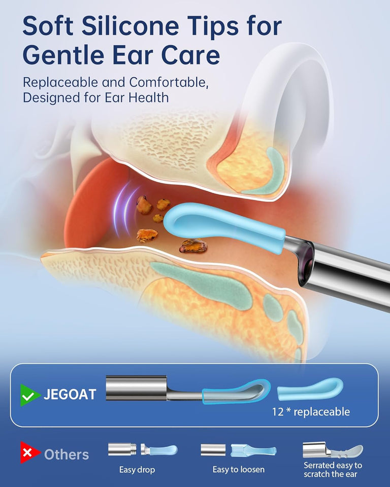 Ear Wax Removal, Ear Wax Removal Tool Camera with 1296P HD Camera and 6 LED Lights, Ear Cleaner with 10 Ear Pick, Upgraded Ear Wax Removal Kit for iOS and Android, Black