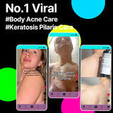 SOME BY MI AHA BHA PHA 30 Days Miracle Acne Clear Body Cleanser 13.5oz – Salicylic Acid & Tea Tree Acne Body Wash – Deep Cleansing, Sulfate & Paraben Free Korean Skin care