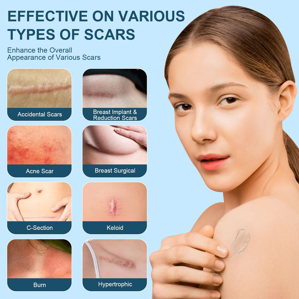 Advanced Scar Gel, Silicone Scar Gel, Treats Old and New Scars, Reduces the Appearance of Scars from, Body, Face, Stretch Marks, Surgical Scar, Keloids, Acne, Burns and More, 50g (1.7 Oz)