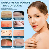 Advanced Scar Gel, Silicone Scar Gel, Treats Old and New Scars, Reduces the Appearance of Scars from, Body, Face, Stretch Marks, Surgical Scar, Keloids, Acne, Burns and More, 50g (1.7 Oz)