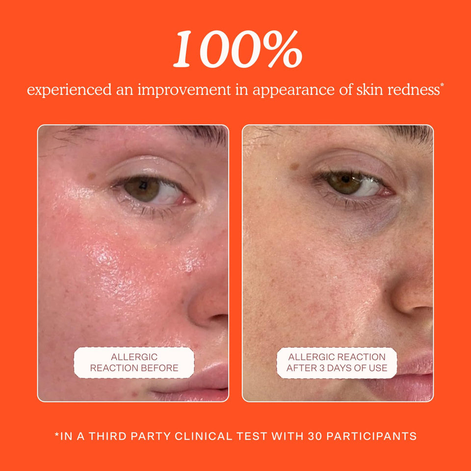 Tower 28 SOS Daily Rescue Facial Spray - Hypochlorous Acid Spray to Help Reduce Redness, Calm Irritation + Alleviate Flare-Ups - Soothing + CWrifying Face Toner - Everyday Skin Care Essential (4 oz)