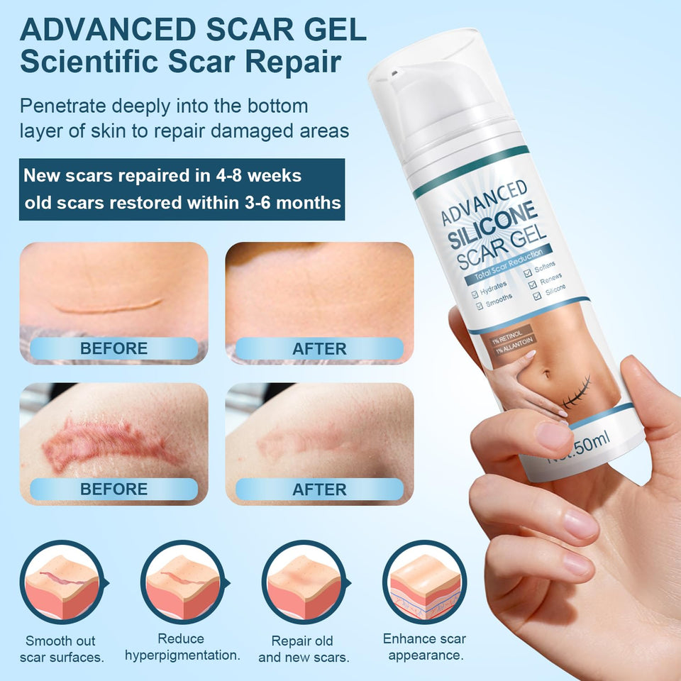 Advanced Scar Gel, Silicone Scar Gel, Treats Old and New Scars, Reduces the Appearance of Scars from, Body, Face, Stretch Marks, Surgical Scar, Keloids, Acne, Burns and More, 50g (1.7 Oz)