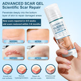 Advanced Scar Gel, Silicone Scar Gel, Treats Old and New Scars, Reduces the Appearance of Scars from, Body, Face, Stretch Marks, Surgical Scar, Keloids, Acne, Burns and More, 50g (1.7 Oz)