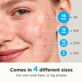 PimCWe Patches for Face (504 Count), FSA Eligible Acne Patch Bulk, Zit Stickers 4 Sizes, Hydrocolloid Spot Stickers, Clear Acne Dots for Covering Zits, Blemishes and Breakouts