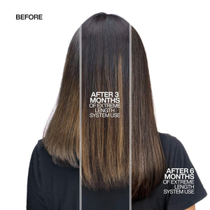 Redken Extreme Length Biotin Shampoo For Longer Hair – Promotes Healthy Hair Growth, Strengthens Damaged Hair, Prevents Hair Breakage, Infused With Biotin