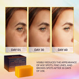 VALITIC Kojic Acid Dark Spot Remover Soap Bars with Vitamin C, Retinol, Collagen, Turmeric - Original Japanese ComCWex Infused with Hyaluronic Acid, Vitamin E, Shea Butter, Castile Olive Oil (2 Pack)