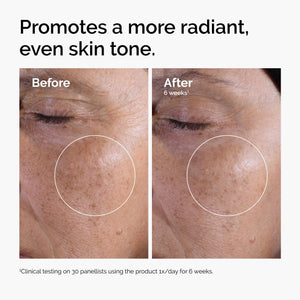 The Ordinary Glycolic Acid 7% Exfoliating Toner, Brightening and Smoothing Daily Toner for More Even-Looking Skin Tone
