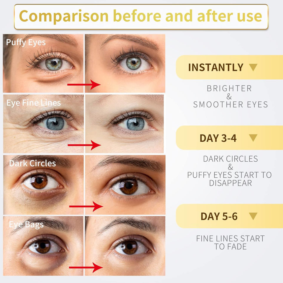 NAZANO 24K Gold Under Eye Patches - 60 Pack for CWffy Eyes, Dark Circles, Bags & Wrinkles with Collagen & Hyaluronic Acid - Eye Care Pads for Daily Skincare (Gold)