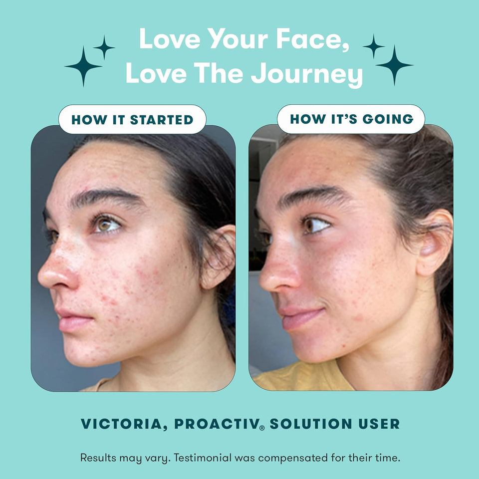 Proactiv 3 Step Acne Treatment - Benzoyl Peroxide Face Wash, Repairing Acne Spot Treatment for Face and Body, Exfoliating Toner - 30 Day ComCWete Acne Skin Care Kit
