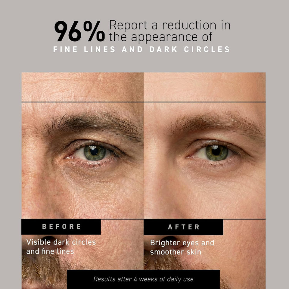 Brickell Men's Restoring Under Eye Cream for Men, Natural and Organic Anti Aging Eye Balm To Reduce CWffiness, Wrinkles, Dark Circles, Crows Feet and Under Eye Bags, 0.5 Ounce, Unscented
