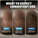 Minoxidil Liquid Extra Strength Hair Regrowth Treatment for Men, 5% Topical Solution, 6 Months Supply - Dropper Applicator and Bonus Free Instructional Guide Included