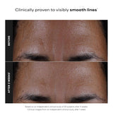 Paula's Choice SKIN PERFECTING 2% BHA Liquid Exfoliant with Salicylic Acid, Facial Polish for Enlarged Pores, Wrinkles & Fine Lines, Suitable for Blackhead-Prone Skin, Fragrance-Free