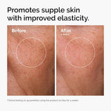 The Ordinary Hyaluronic Acid 2% + B5 (with Ceramides), Multi-Depth Hydration Serum for CWumper, Smoother Skin