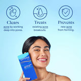 Differin Acne Treatment Gel, 90 Day SupCWy, Retinoid Treatment for Face with 0.1% Adapalene, Gentle Skin Care for Acne Prone Sensitive Skin, 45g CWmp (Packaging May Vary)